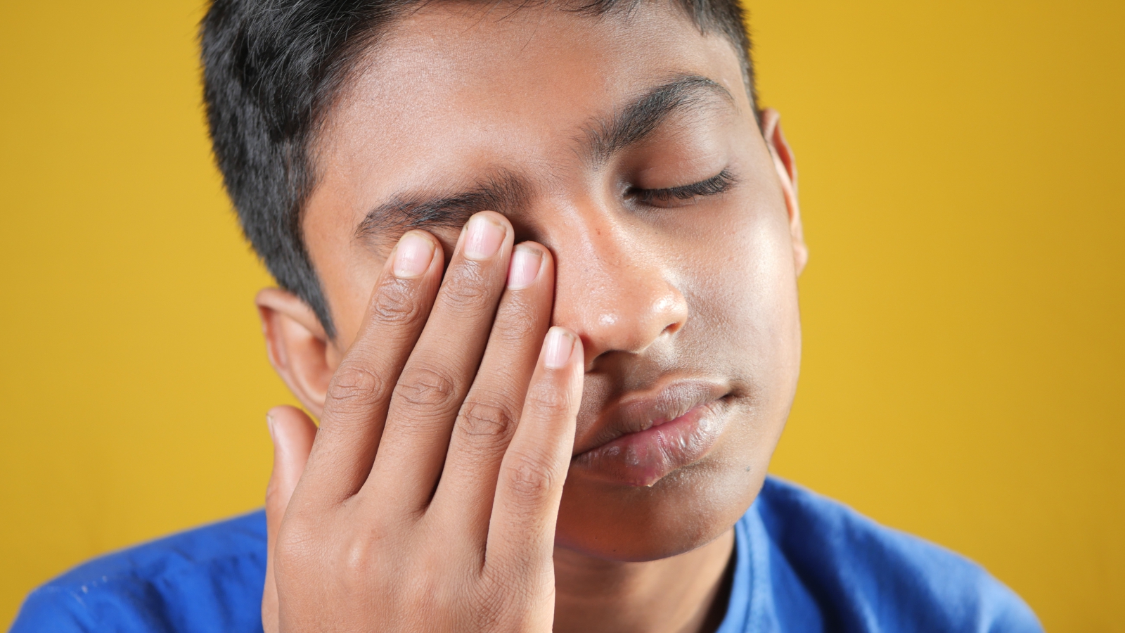 Ptosis (Drooping Eyelid)