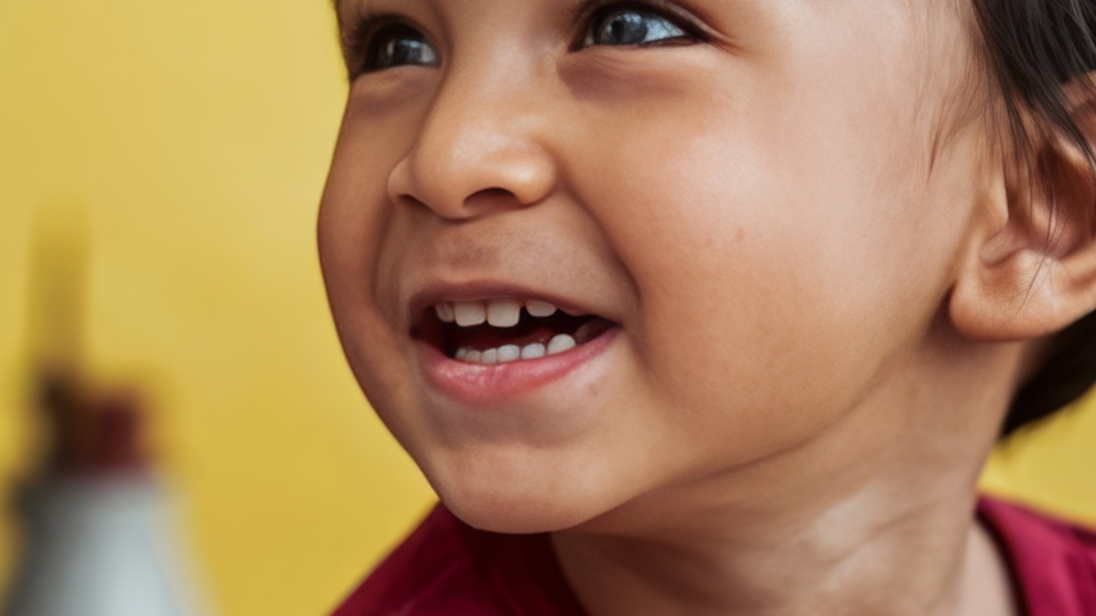 Malocclusion