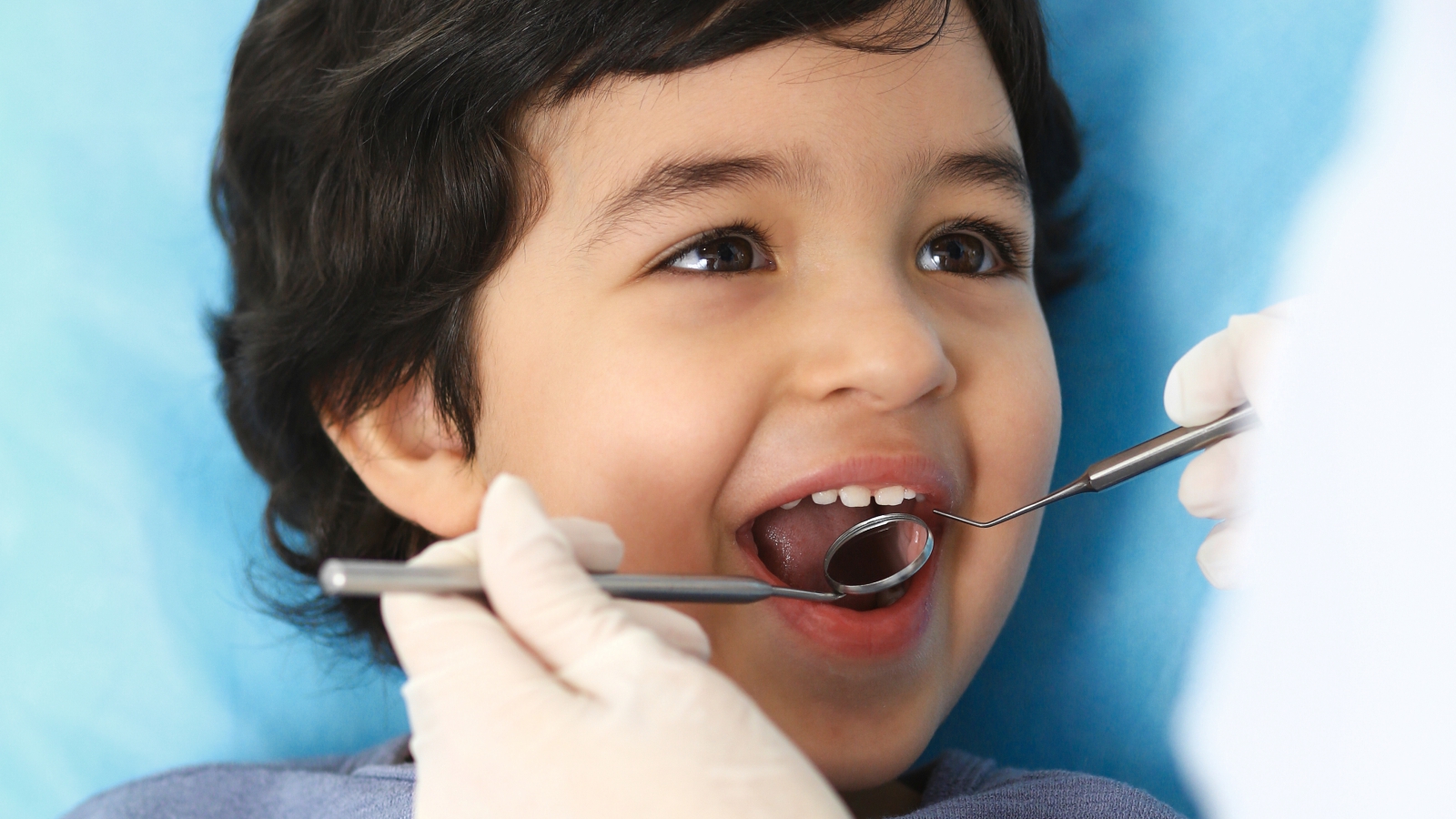 Tooth Decay & Cavities